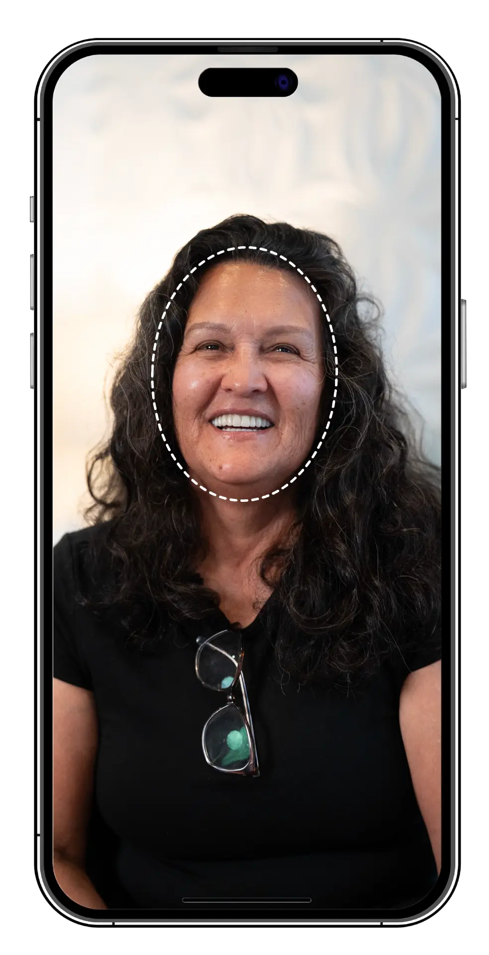 Phone screen showing a patient's smiling photo with an AI smile-preview outline